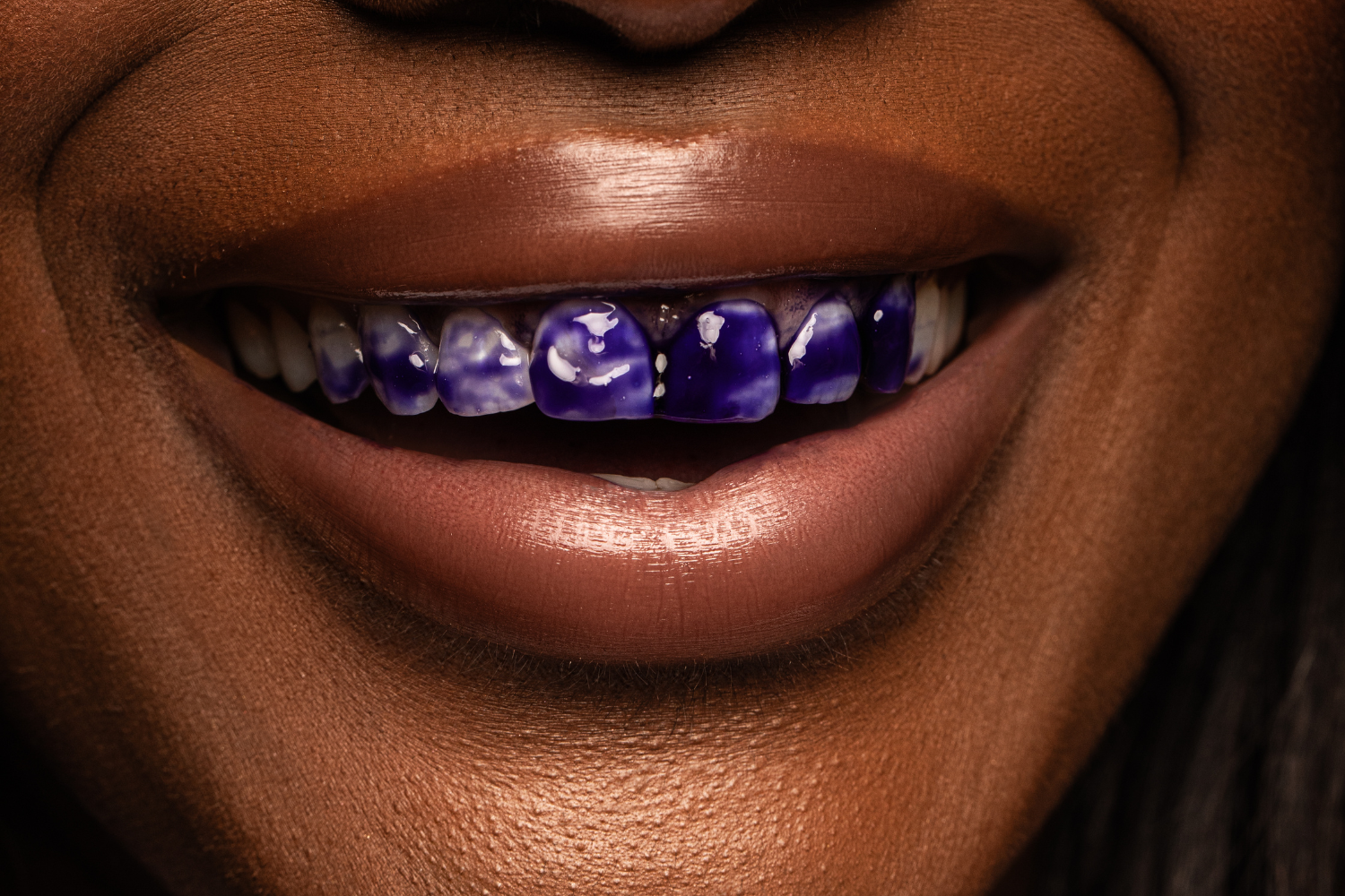 V34 & PAP+ Penna sbiancante